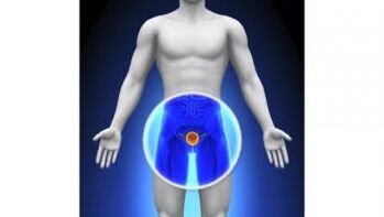 prostatitis in a man