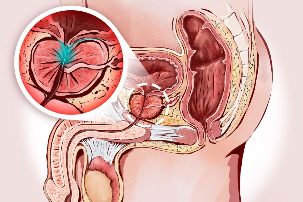 the diagnosis of the