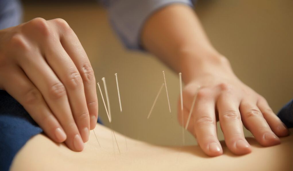 Acupuncture is a common method of treating chronic prostatitis.