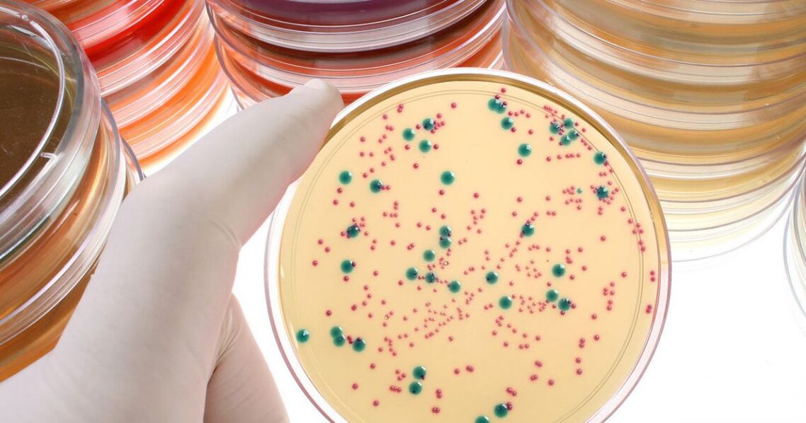 Chronic bacterial prostatitis is detected by analyzing urine and prostate secretions.